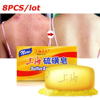 8Pcs Xangai Enxofre Sabão 125g de Tratamento de Psoríase Seborréia Eczema de Óleo de Controle de Acne Anti Fungo Banheira Saudável Sabonetes Eczema 8pcs