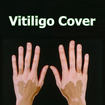 Pele Vitiligo Concealer Maquiagem Caneta Impermeável de Longa duração Cobertura Natural Sem Tratamento no Rosto de Corpo para as Mulheres, Homens Mancha Branca